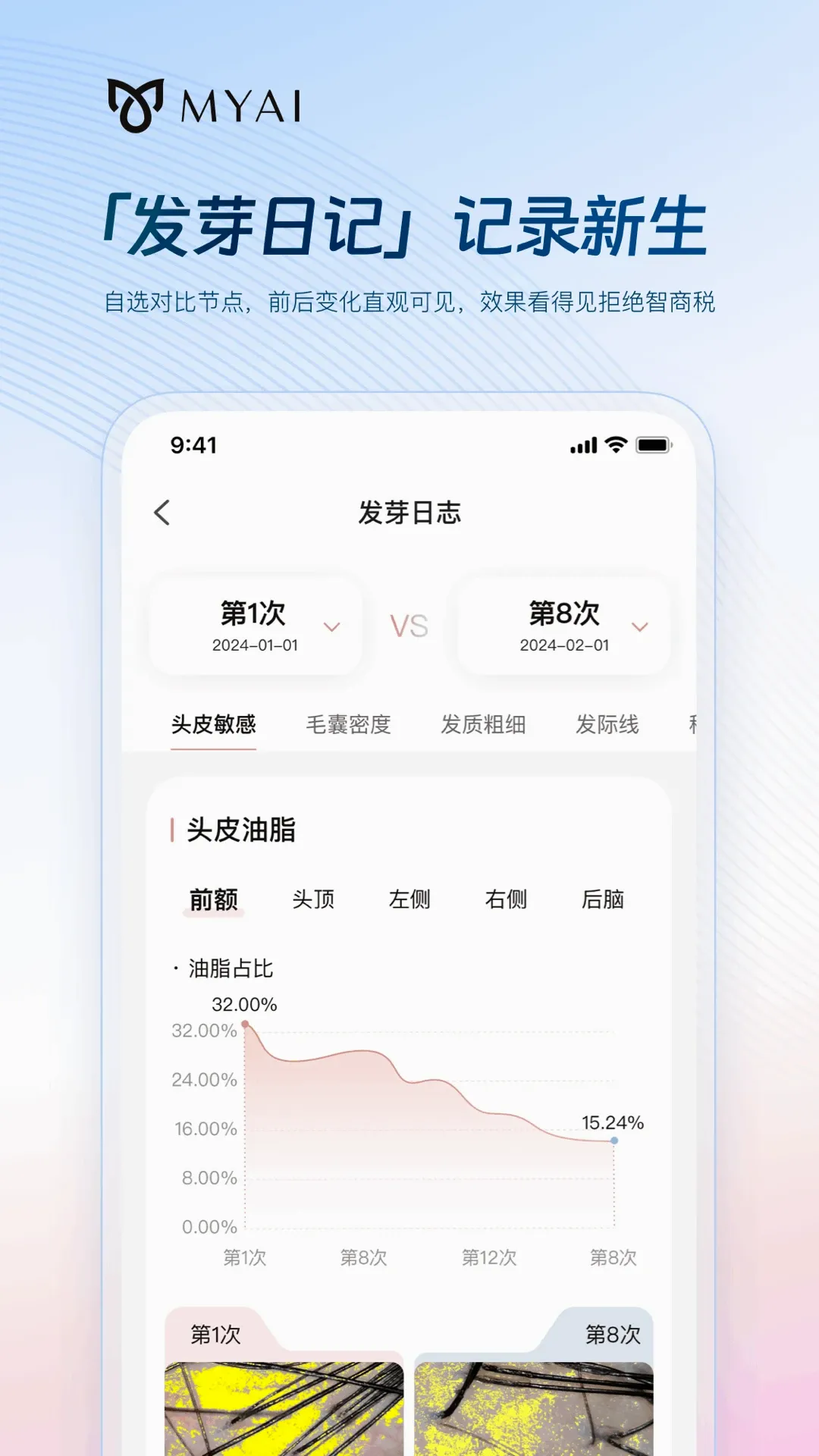 MYAI�����ռ�(������������)v1.1.3 ��׿��